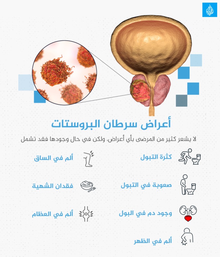 أعراض سرطان البروستات البروستاتا صحة الرجل prostate cancer