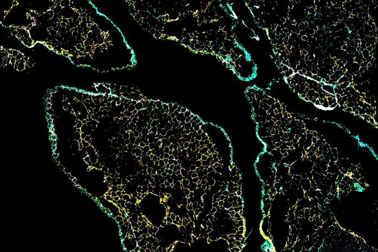 Confocal microscopy fluorescent images of a human omental adipose tissue section (visceral fat), depicting the mesothelial cell layer surrounding lobules of adipocytes. In the image, adipocytes are visualized using a staining against perilipin 1 (PLIN1, in yellow), while mesothelial cells are stained using TM4SF1 (green) and MSLN (pink). DAPI staining was used to visualize cellular nuclei (cyan). Credit to: CREDIT Radiana Ferrero and Julie Russeil (EPFL)