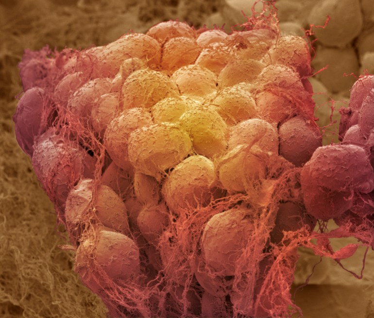 Fat tissue. Coloured scanning electron micrograph (SEM) of a sample of fat tissue, showing fat cells (adipocytes, red yellow) surrounded by fine strands of supportive connective tissue. Adipocytes are among the largest cells in the human body, each cell being 100 to 120 microns in diameter. Almost the entire volume of each fat cell consists of a single lipid (fat or oil) droplet. Adipose tissue forms an insulating layer under the skin, storing energy in the form of fat, which is obtained from food. Magnification: x300 when printed 10 centimetres wide.